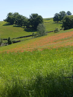 Rolling Hills and Trees