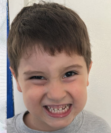 Young boy with brown hair making a wide grinning silly face, close-up portrait