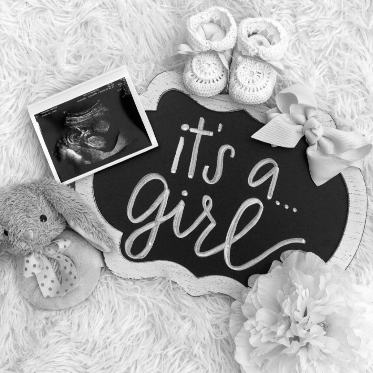 Black and white baby announcement with an ultrasound photo, baby shoes, teddy bear, bow, flower, and sign
