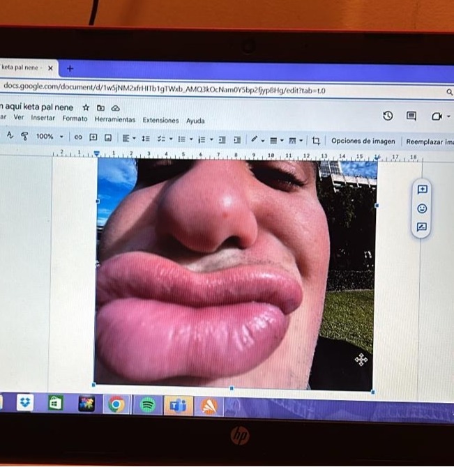 Laptop screen showing a close-up distorted face photo in a document editor